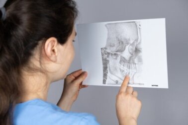 Che cos'è la retrognazia mandibolare e qual è il suo trattamento?
