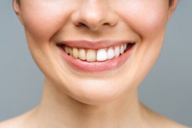 La nuova sfida di TikTok mette a rischio la salute dei denti