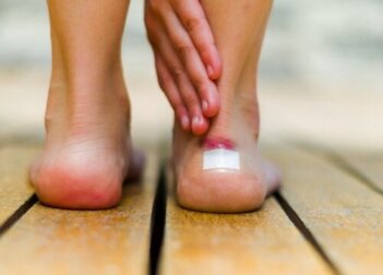 Irritazione cutanea da attrito: cause e trattamento