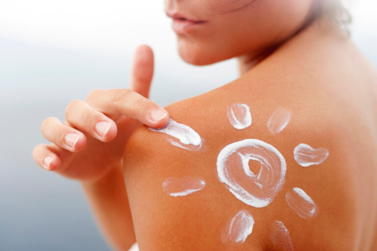 5 ingredienti chiave per alleviare le scottature solari